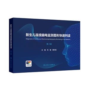 Bm(x)X늱O(jin)yDοx(2)