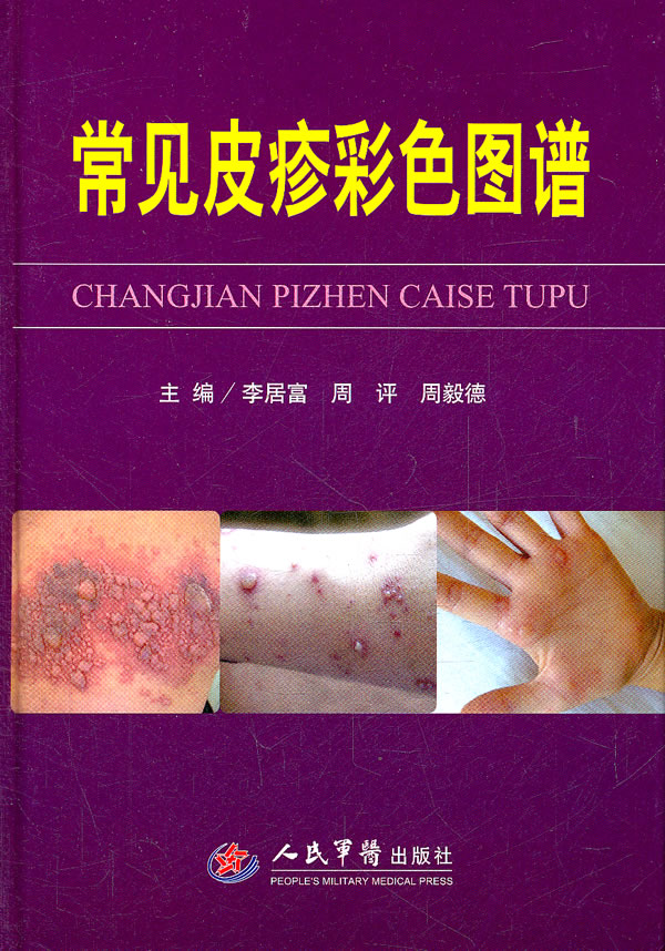 常见皮疹彩色图谱