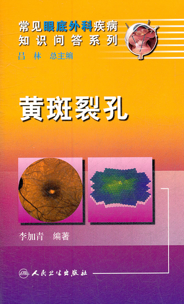 黄斑裂孔