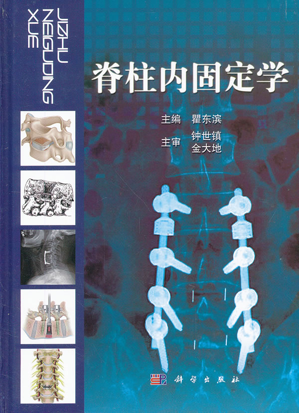 脊柱内固定学