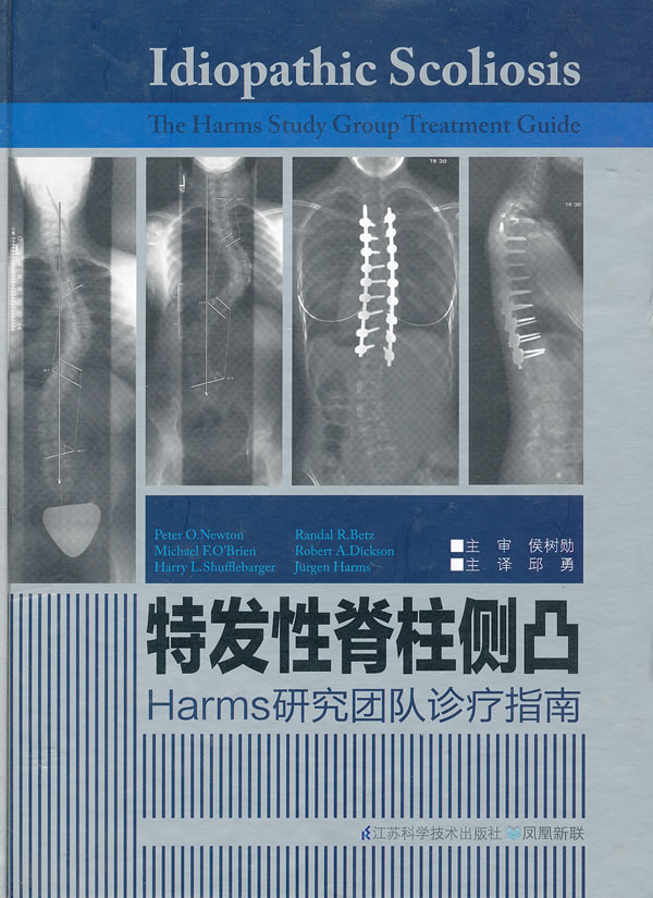 特发性脊柱侧凸-Harms研究团队诊疗指南