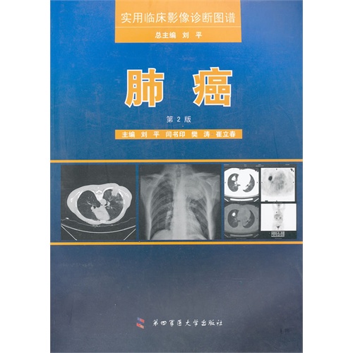 肺癌-实用临床影像诊断图谱-第2版