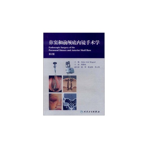 鼻窦和前颅底内镜手术学-第2版