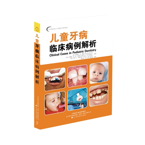 儿童牙病临床病例解析