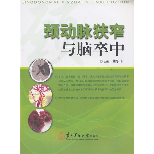 颈动脉狭窄与脑卒中