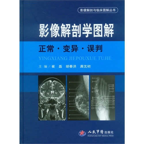 影像解剖学图解:正常·变异·误判