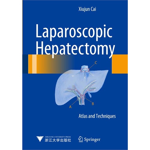 Laparoscopic Hepatectomy-腹腔镜肝切除术:图谱和技术