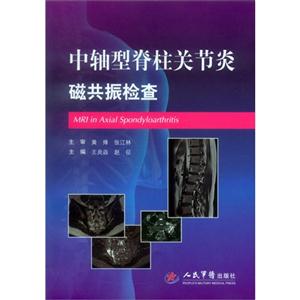 中轴型脊柱关节炎磁共振检查-技术教育社区