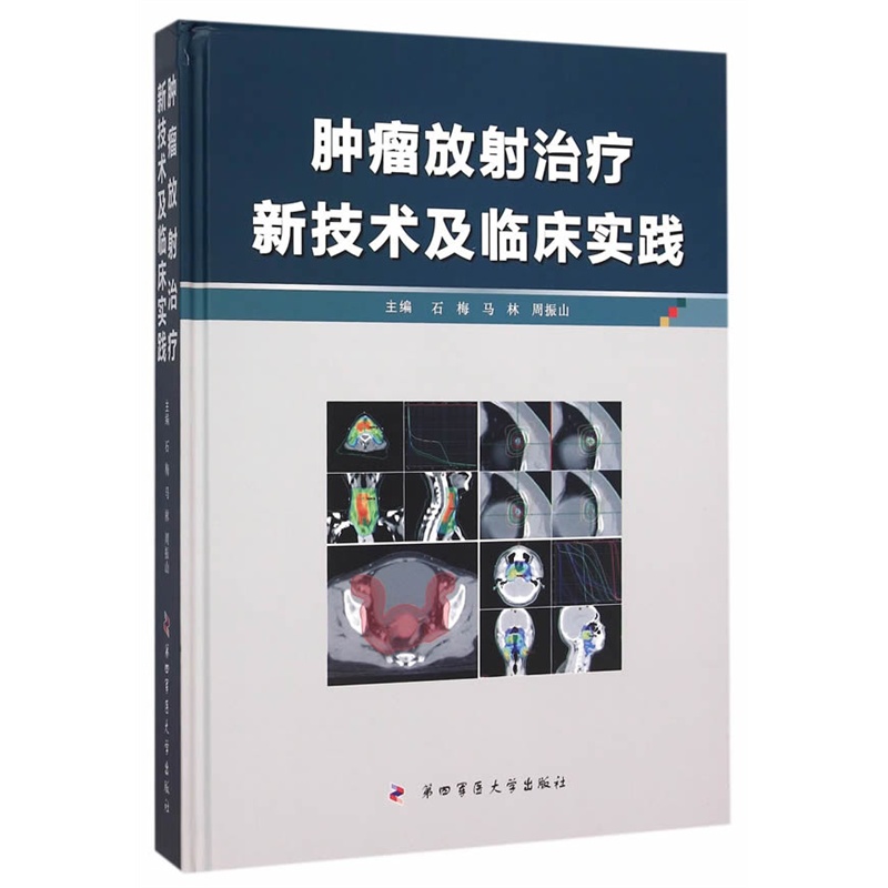 肿瘤放射治疗新技术及临床实践