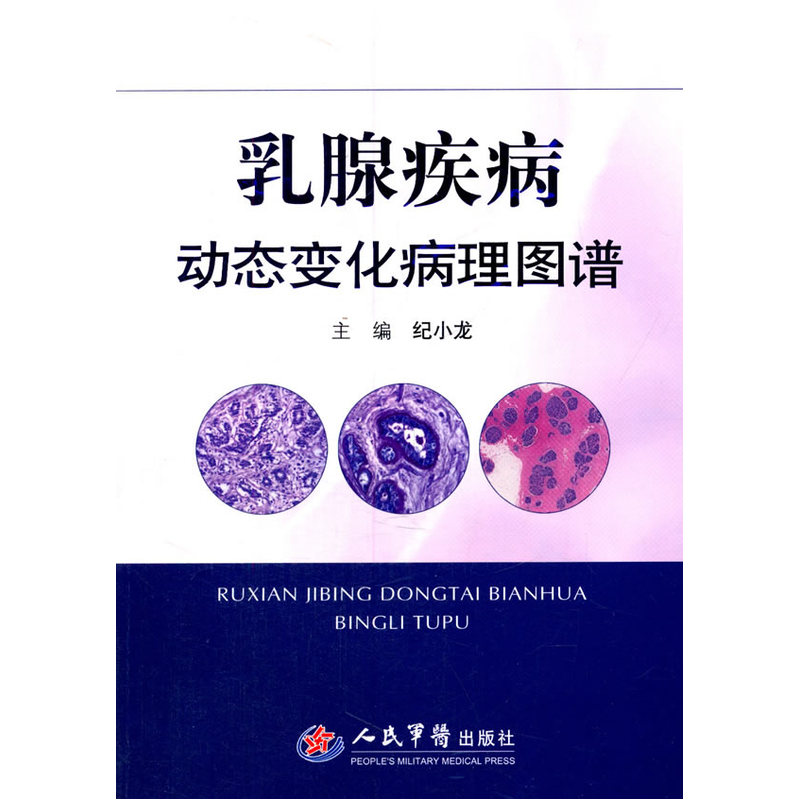 乳腺疾病动态变化病理图谱