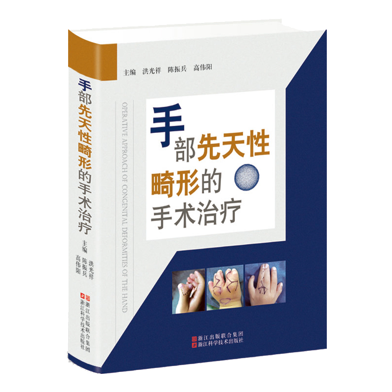 手部先天性畸形的手术治疗