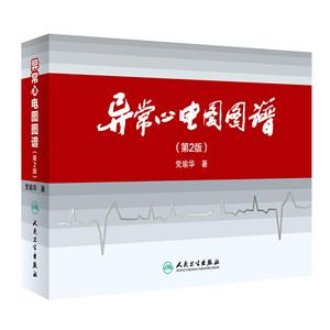 异常心电图图谱-技术教育社区