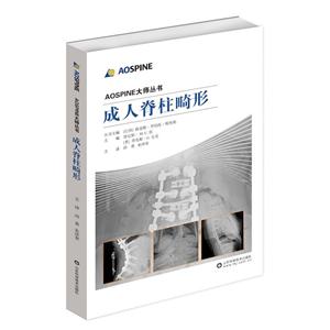 成人脊柱畸形-技术教育社区