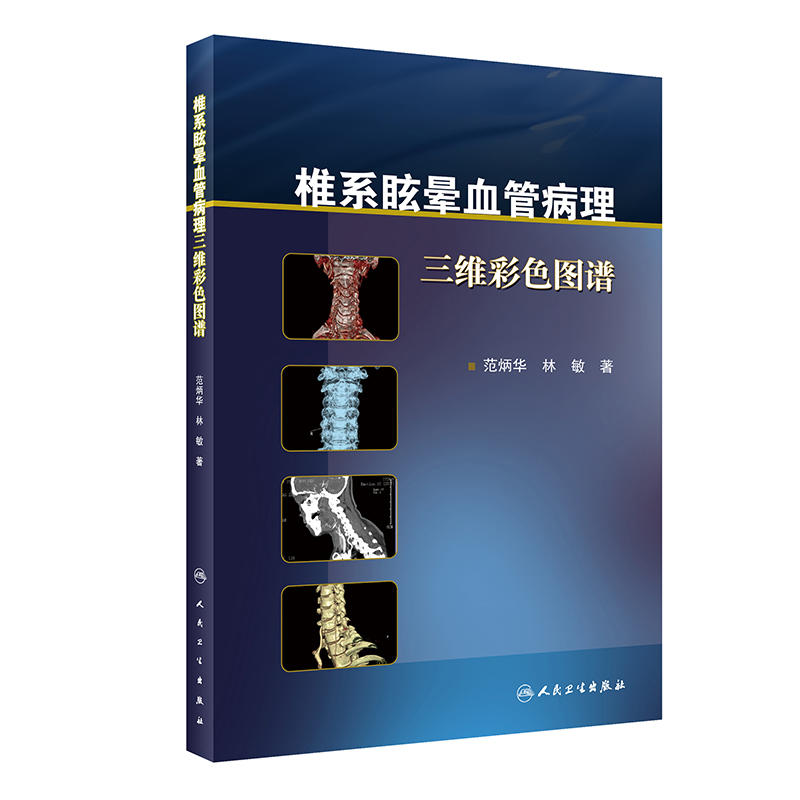 椎系眩晕血管病理三维彩色图谱