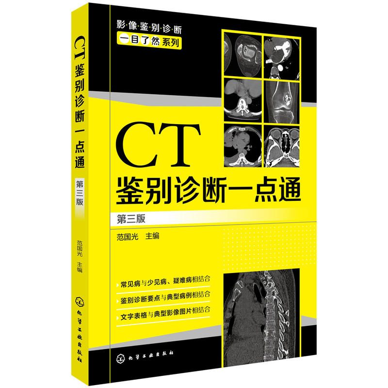 CT鉴别诊断一点通-第三版