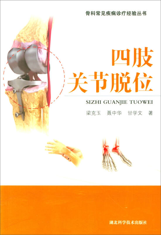 四肢关节脱位