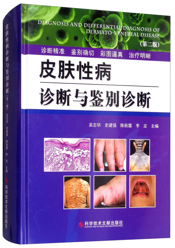 皮肤性病诊断与鉴别诊断(第2版)