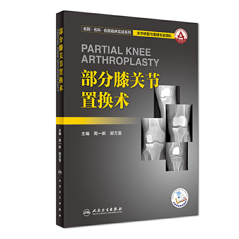 部分膝关节置换术