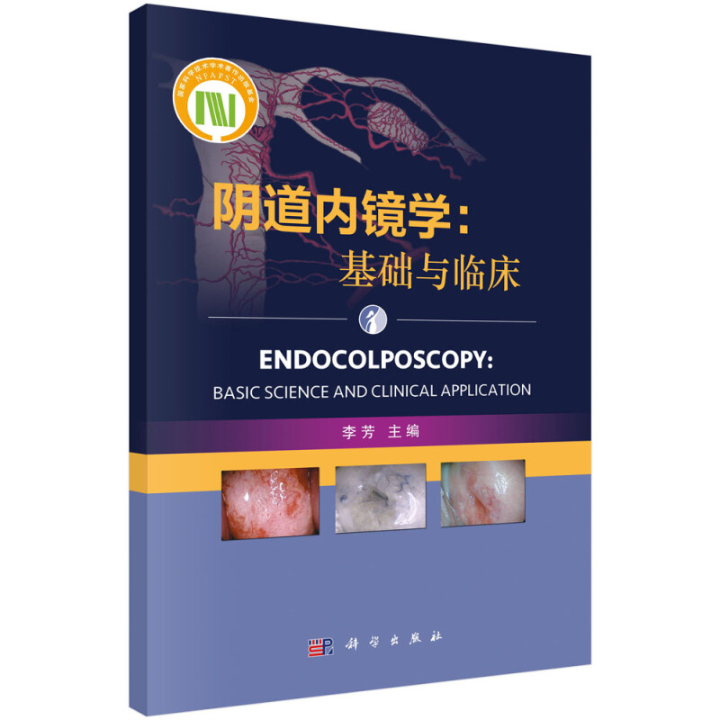 阴道内镜学:基础与临床:basic science and clinical application