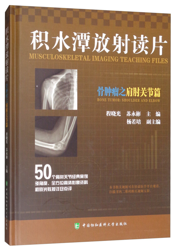 积水潭放射读片——骨肿瘤之上肢篇