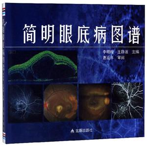 简明眼底病图谱-技术教育社区