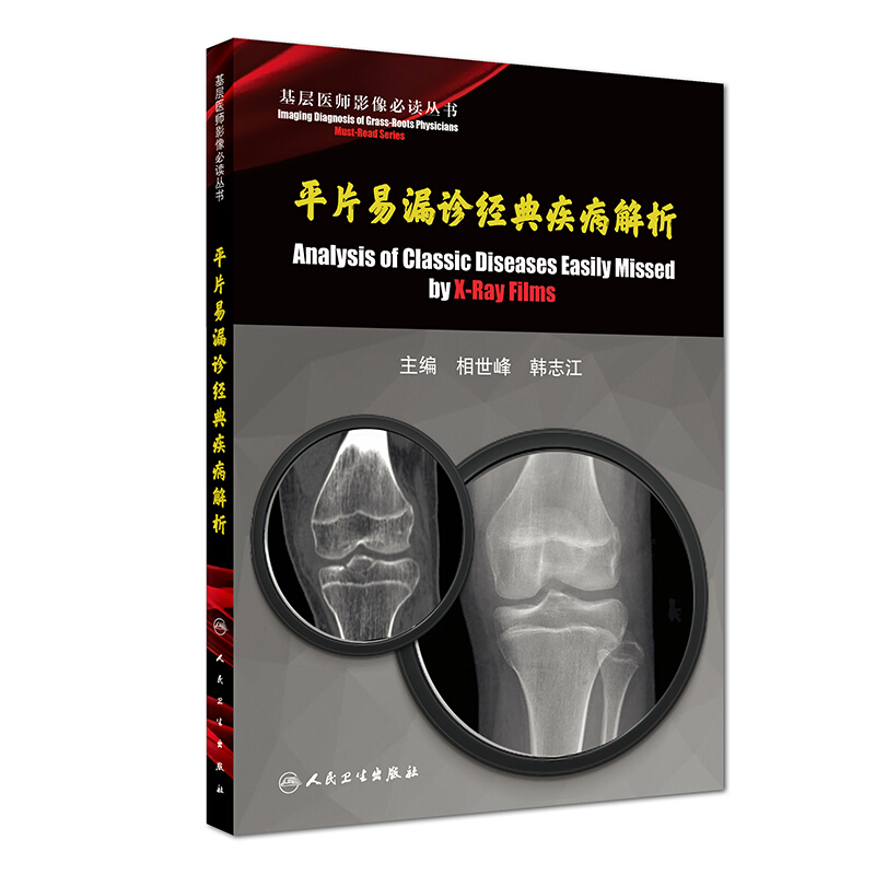 基层医师影像必读丛书/平片易漏诊经典疾病解析