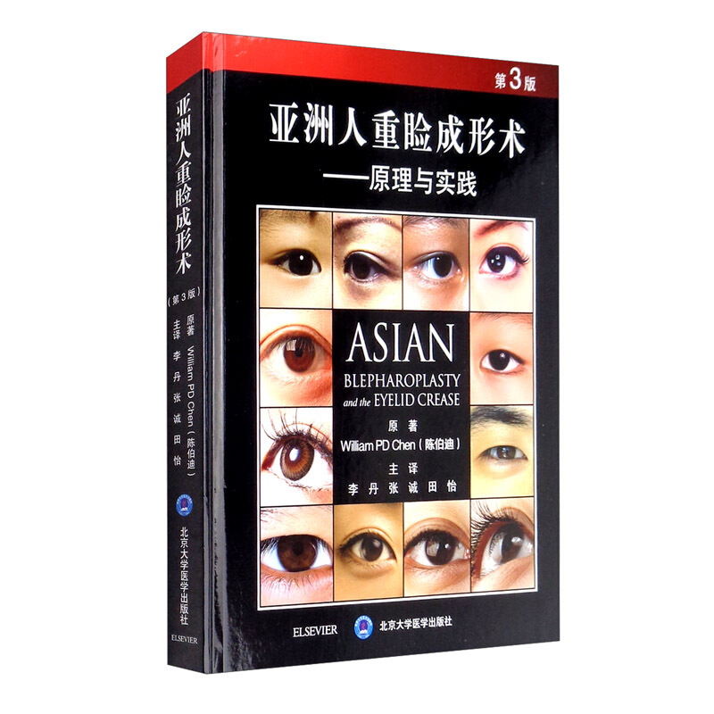 亚洲人重睑成形术:原理与实践
