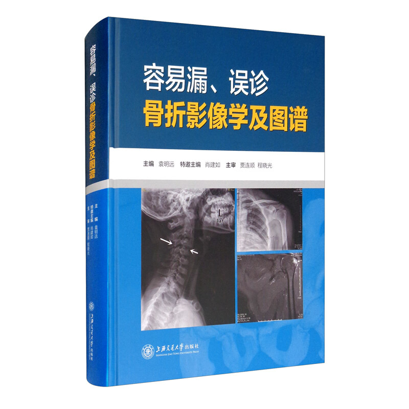 容易漏、误诊骨折影像学及图谱