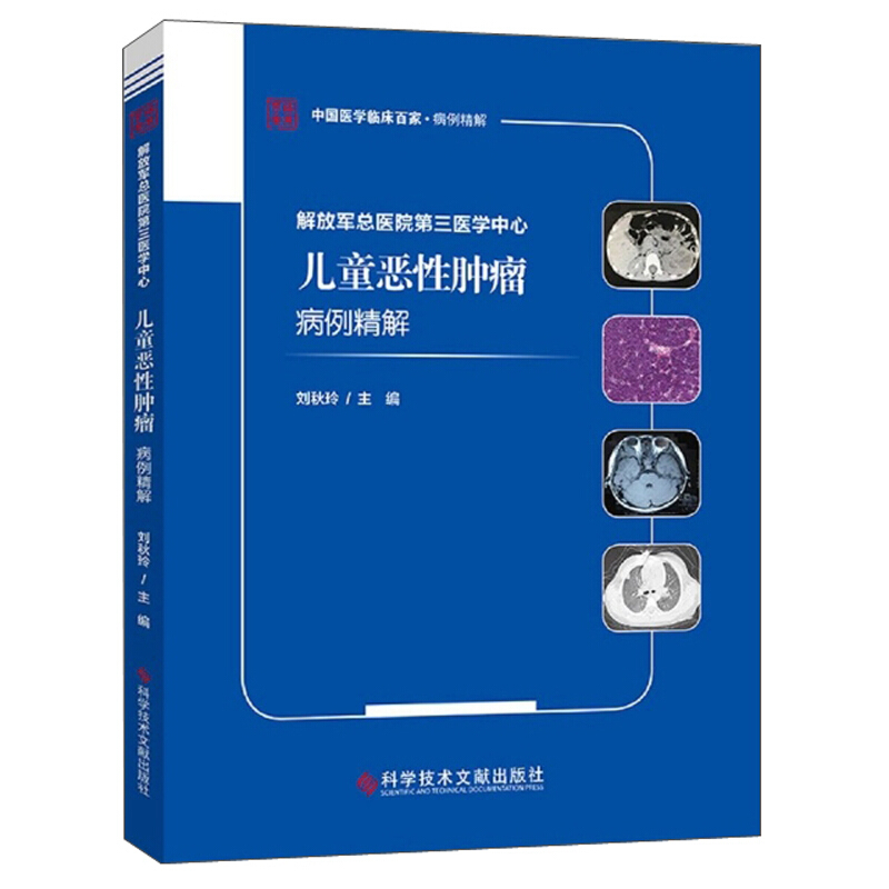 解放军总医院第三医学中心儿童恶性肿瘤病例精解