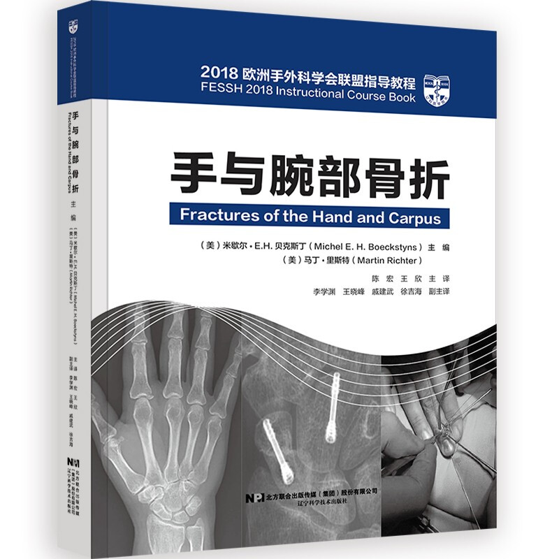 手与腕部骨折:2018欧洲手外科学会联盟指导教程