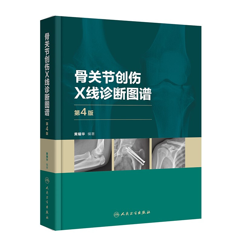 骨关节创伤X线诊断图谱(第4版)