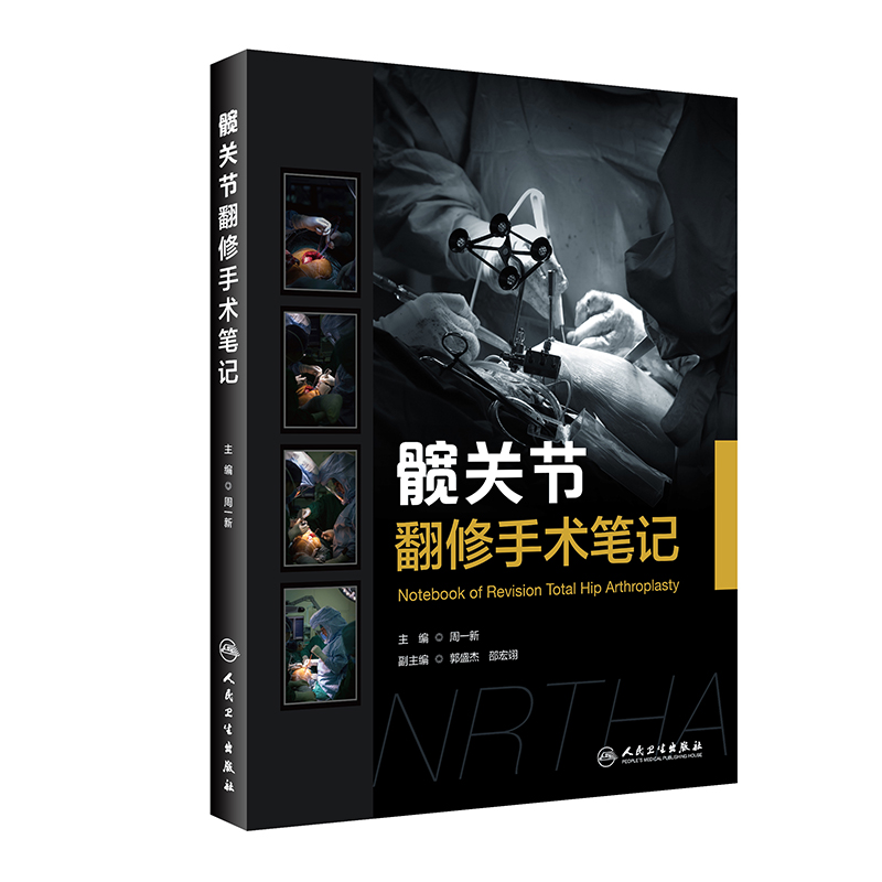 髋关节翻修手术笔记(精)