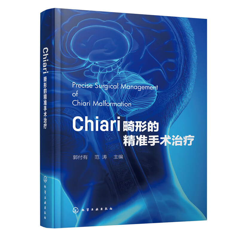 Chiari畸形的精准手术治疗