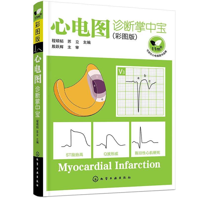 心电图诊断掌中宝(彩图版)
