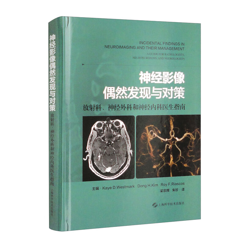 神经影像偶然发现与对策:放射科、神经外科和神经内科医生指南