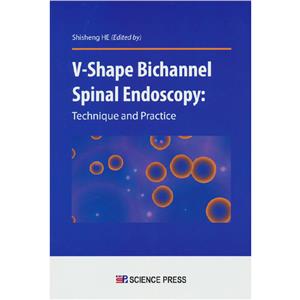 V-shape bichannel spinal endoscopy: technique and practice