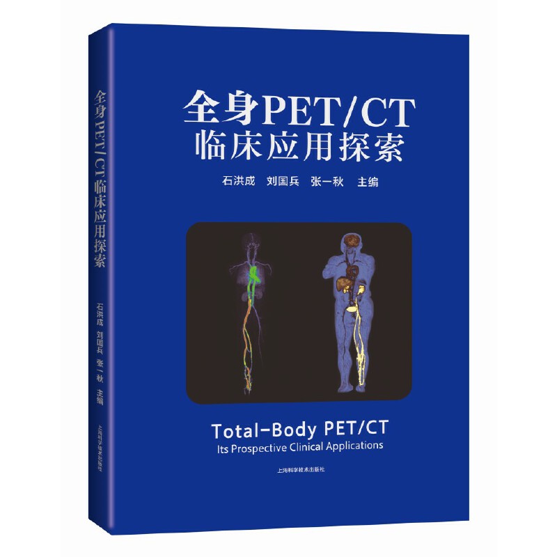 全身PET/CT临床应用探索