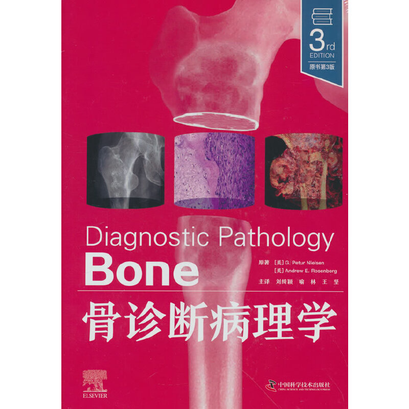 骨诊断病理学(原书第3版)