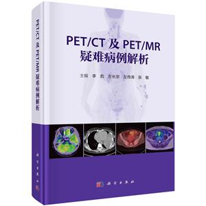 PET/CT及PET/MR疑难病例解析-技术教育社区