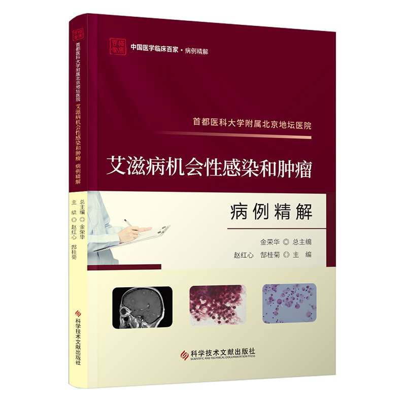 首都医科大学附属北京地坛医院艾滋病机会性感染和肿瘤病例精解