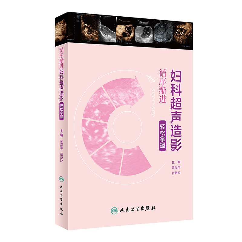 循序渐进:妇科超声造影轻松掌握