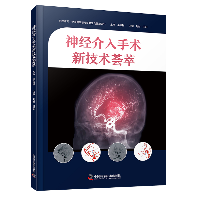 神经介入手术新技术荟萃
