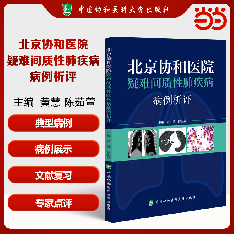 北京协和医院疑难间质性肺疾病病例析评