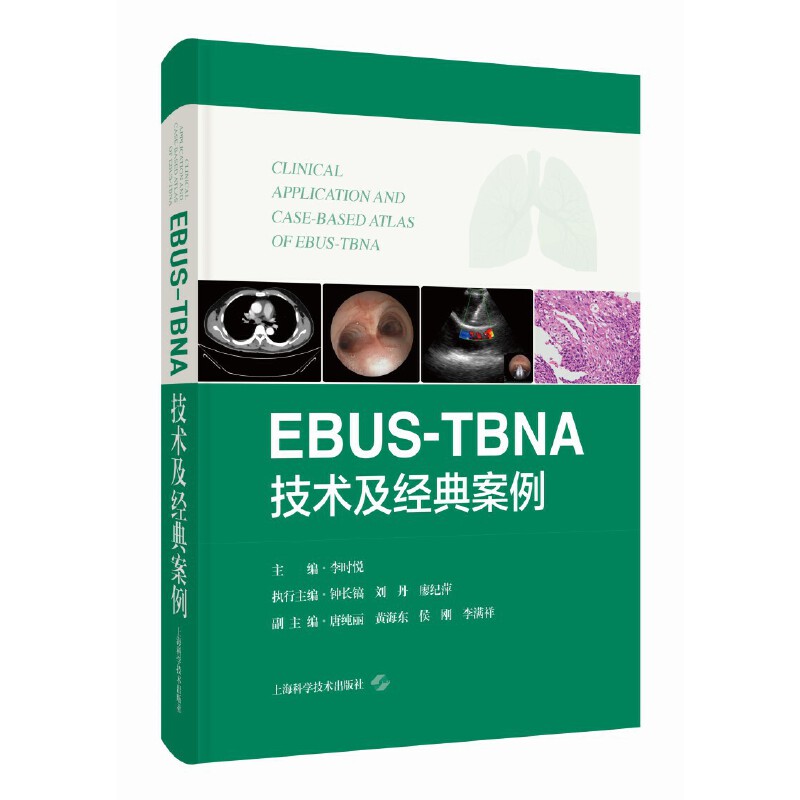 EBUS-TBNA技术及经典案例