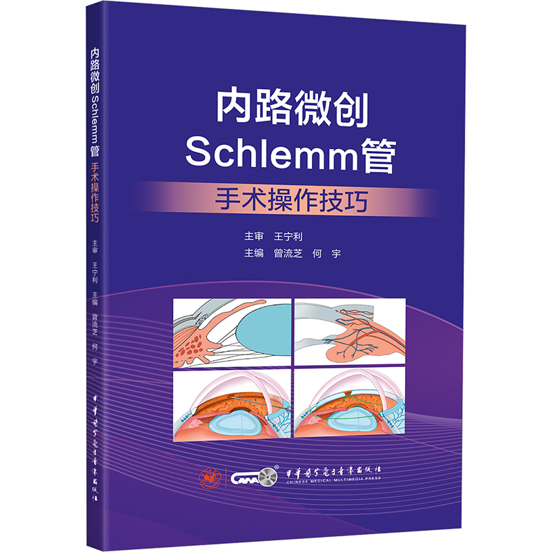 内路微创Schlemm管手术操作技巧