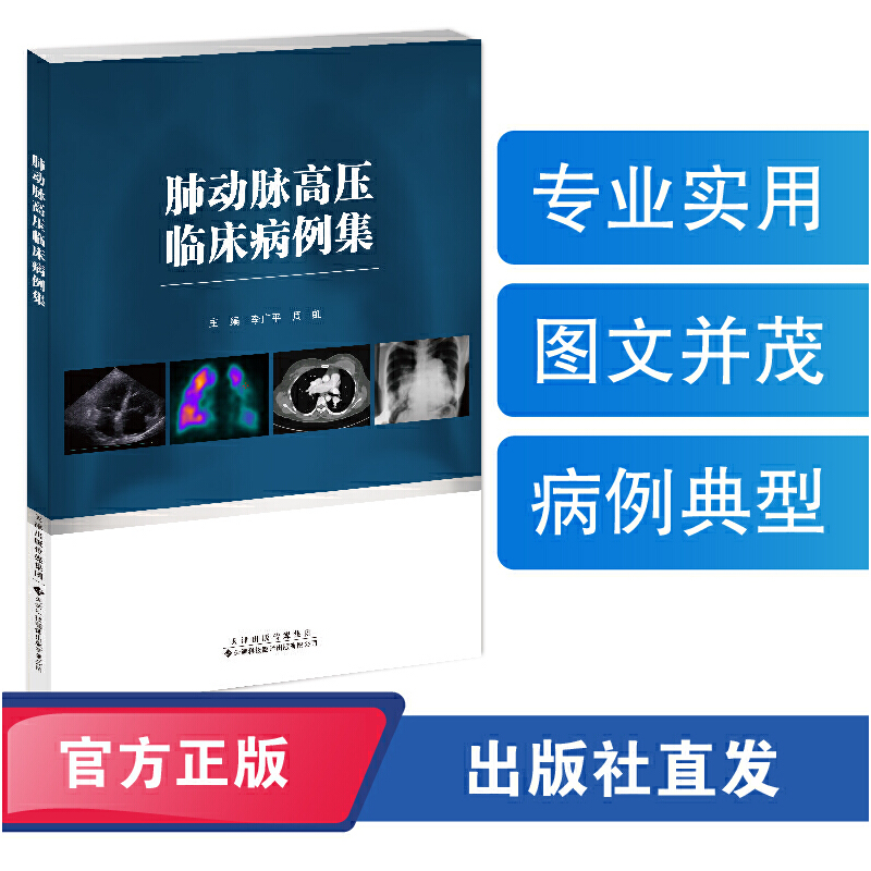 肺动脉高压临床病例集