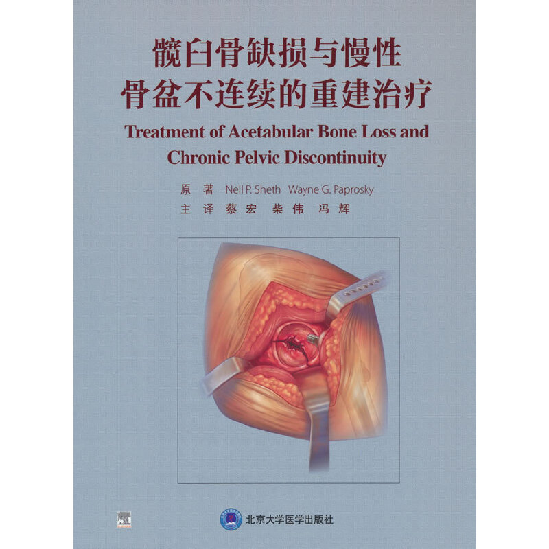髋臼骨缺损与慢性骨盆不连续的重建治疗