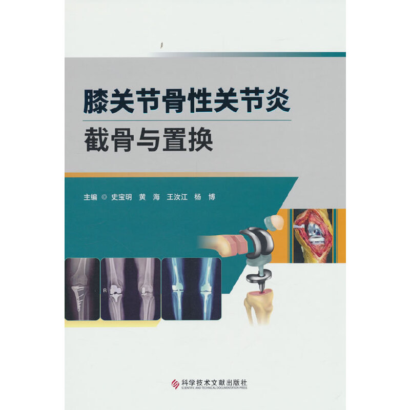 膝关节骨性关节炎截骨与置换